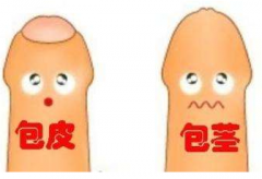 手术可以治疗包皮过长吗